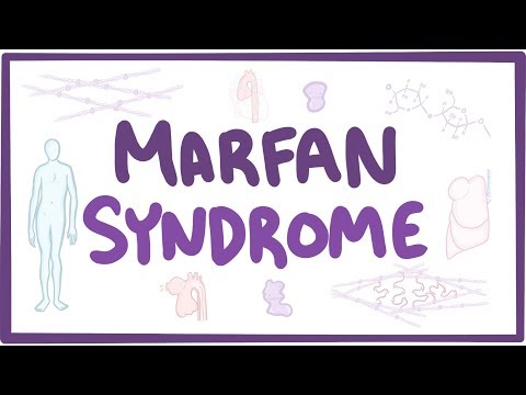 Marfan Syndrome - causes, symptoms, diagnosis, treatment, pathology