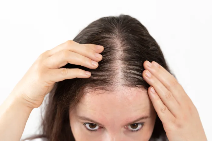 Close-up of woman controls hair loss and little volume with fine hair against white background