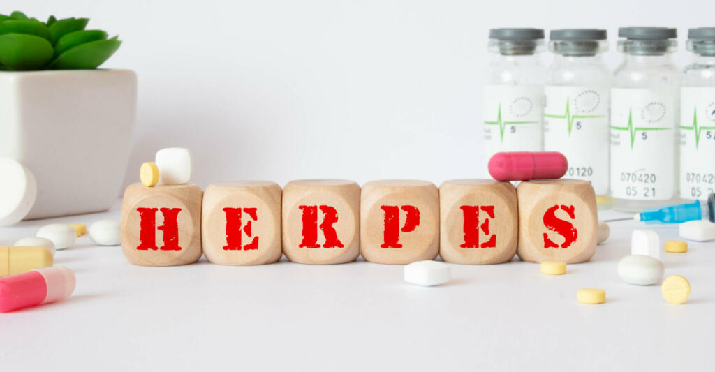 Herpes - word from wooden blocks with letters, viral diseases herpes viruses concept, blue background.
