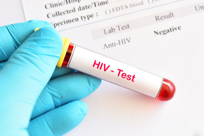 Napredek pri cepivu proti HIV