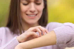 Stressed teen scratching itchy arm in a park