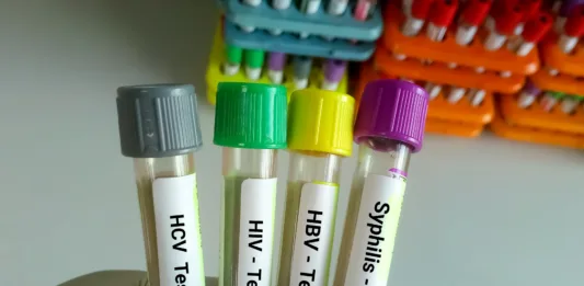 Scientist hold blood samples tube for Sexuallly Transmitted Disease. Syphilis,  HBV, HIV, HCV