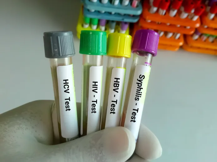 Scientist hold blood samples tube for Sexuallly Transmitted Disease. Syphilis,  HBV, HIV, HCV