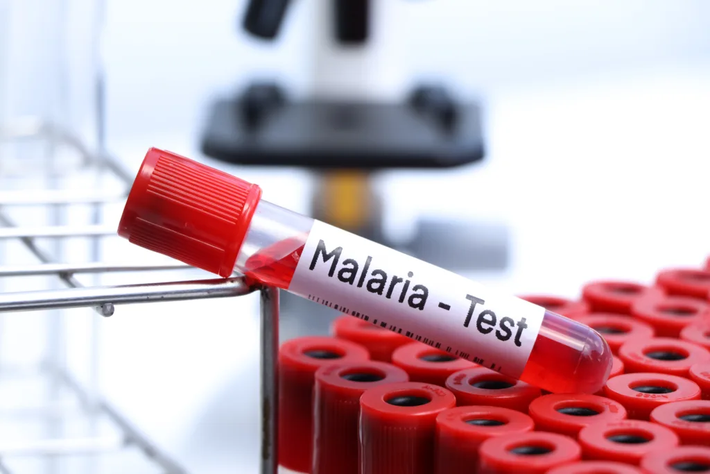 Malaria test to look for abnormalities from blood, blood sample to analyze in the laboratory, blood in test tube