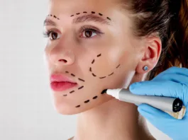 Facial Aesthetics Facelift. Plastic Surgery Drawings On Face