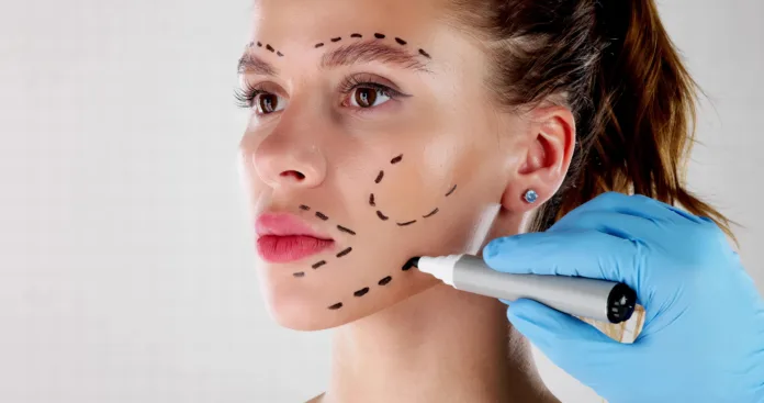 Facial Aesthetics Facelift. Plastic Surgery Drawings On Face