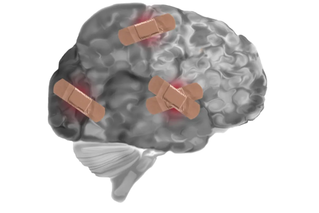 Grey matter or brain with bandaids on damaged parts