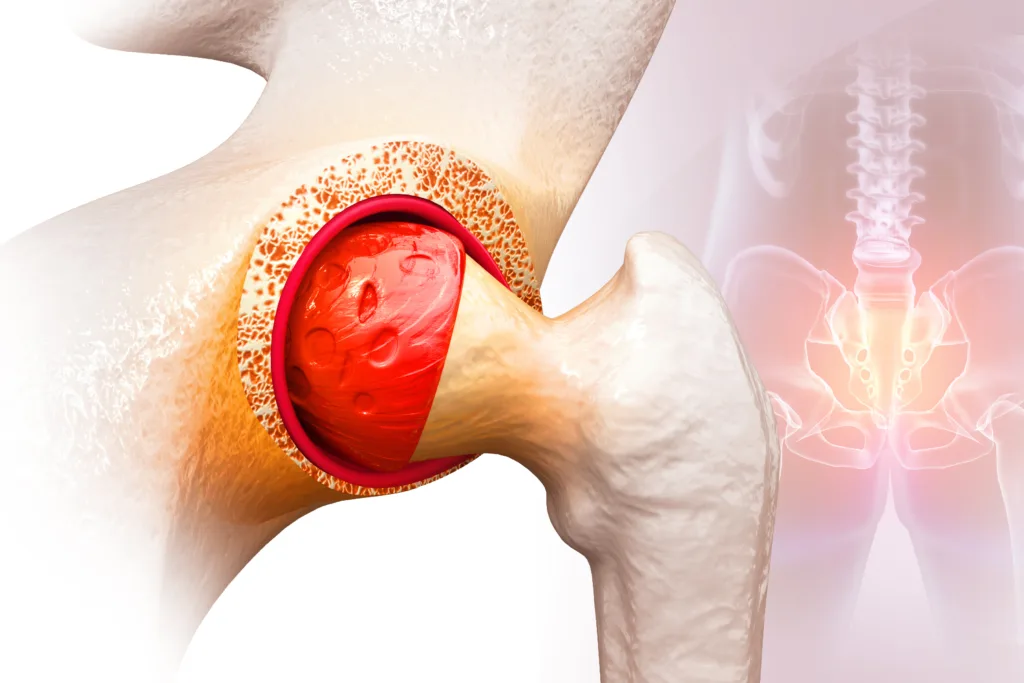 Hip joint Pain, Bones of the pelvis and hip. 3d illustration